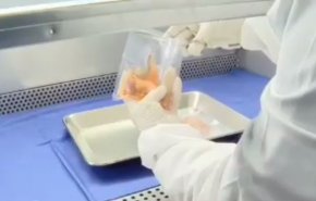 إيران بين أفضل عشر دول في إنتاج صمامات القلب من الأنسجة البشرية
