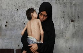 يونيسف: أكثر من 5 آلاف طفل بغزة أصيبوا بسوء التغذية خلال 15 يوما