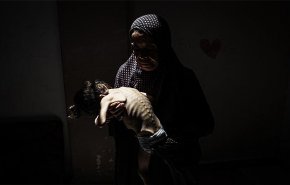 المجاعة تفتك بأطفال غزة والعالم مطالب برؤية الحقيقة