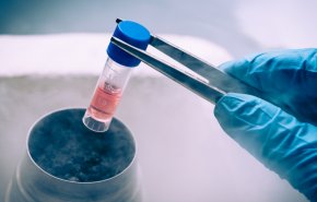 إيران تكسر الحواجز..الثامنة عالمياً في مجال العلاج بالخلايا الجذعية