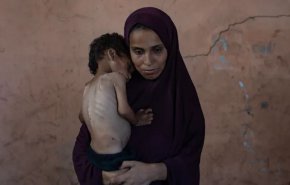 14 صورة لأطفال مجوّعين تفضح أكاذيب نتنياهو