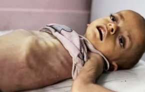 أكثر من 500 ألف طفل دون الخامسة مهددون بالموت