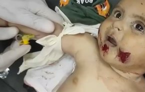 عشرات الشهداء والجرحى إثر مواصلة القصف واستهداف المجوعين في غزة + فيديو