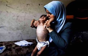 الأمم المتحدة تعلن رسميا تفشي المجاعة في غزة