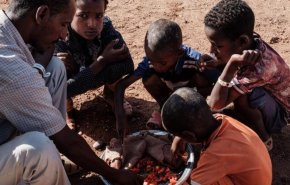 سوء التغذية في السودان..وفاة 46 شخصًا خلال شهرين