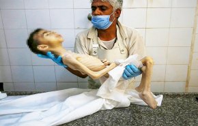 التجويع الإحتلال لغزة يقتل 11 فلسطينيا والحصيلة ترتفع إلى 300