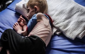 الاحتلال يطالب الأمم المتحدة بسحب تقرير المجاعة في غزة!