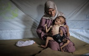 حصيلة ضحايا المجاعة في غزة ترتفع إلى 332 شهيدًا