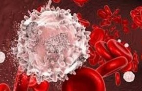 إنتاج أحد أكثر أدوية سرطان الدم تعقيدا في إيران