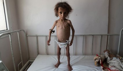 تشدید بحران انسانی در یمن‎
