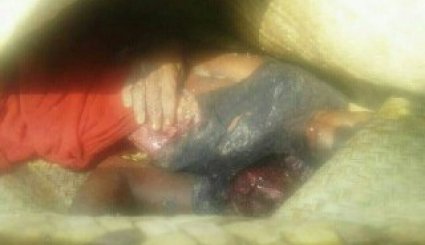 تصاویری دلخراش از جنایت مزدوران آل سعود در کشتار صیادین در جزیره البضیع
