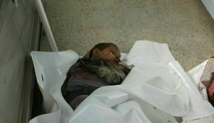 شهادت 3 کودک و زخمی شدن 18 نفر در حمله متجاوز سعودی به صعده + تصاویر
