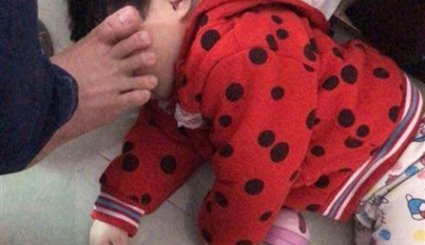 صور مروعة لطفلة حبسها والدها في قفص للكلاب!!