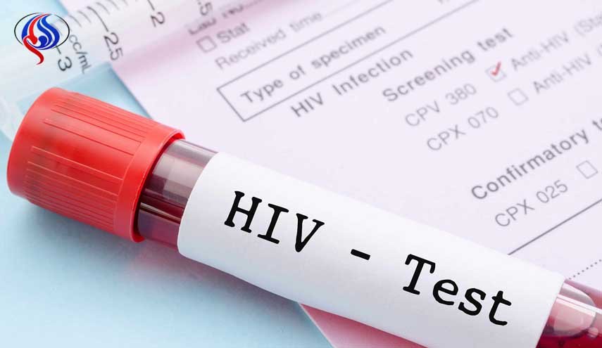 آزمایش ایدز پیش از ازدواج اجباری شود