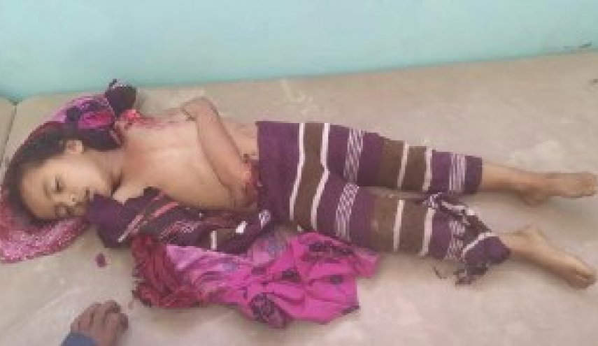 تصویری از شهادت دختربچه یمنی در حمله هوایی سعودی‌ها 18+