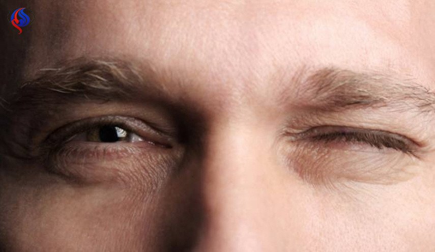ما سبب حدوث رفة العين  و ما علاجها؟