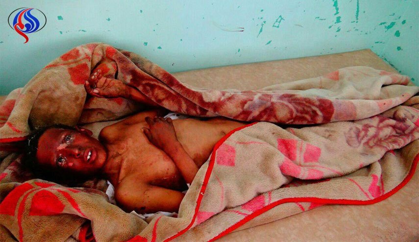 تصاویری از جنایت هولناک ائتلاف سعودی در الجوف یمن
