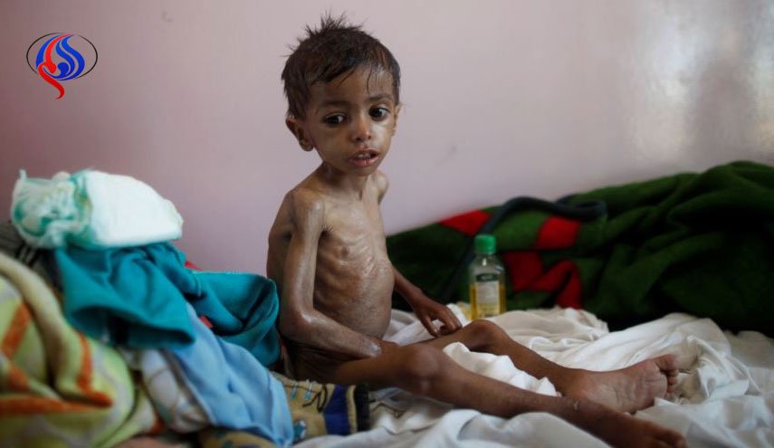 یونیسف: 400 هزار کودک یمنی با خطر مرگ مواجه هستند