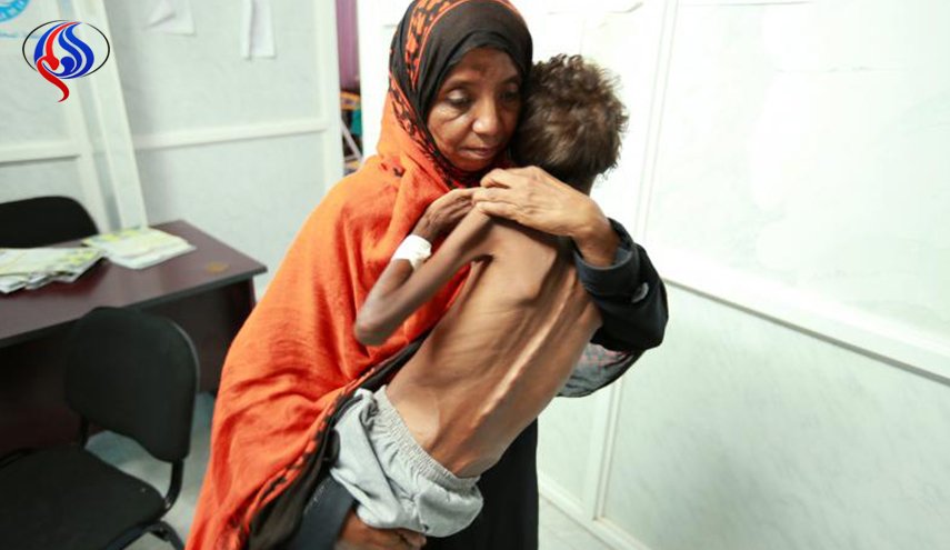 المجاعة في اليمن .. عار سيلاحق الإنسانية الى الأبد