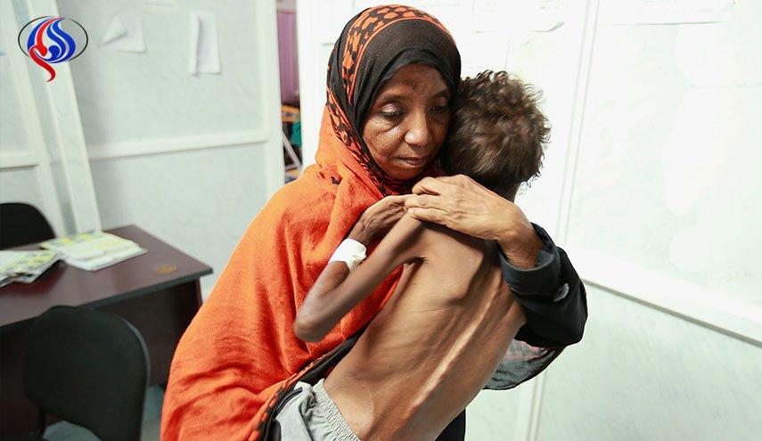 8 ملايين يمني على شفا المجاعة