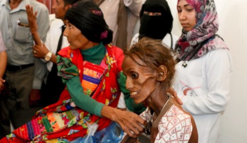 أوكسفام: اليمن يقترب نحو المجاعة أكثر من أي وقت مضى