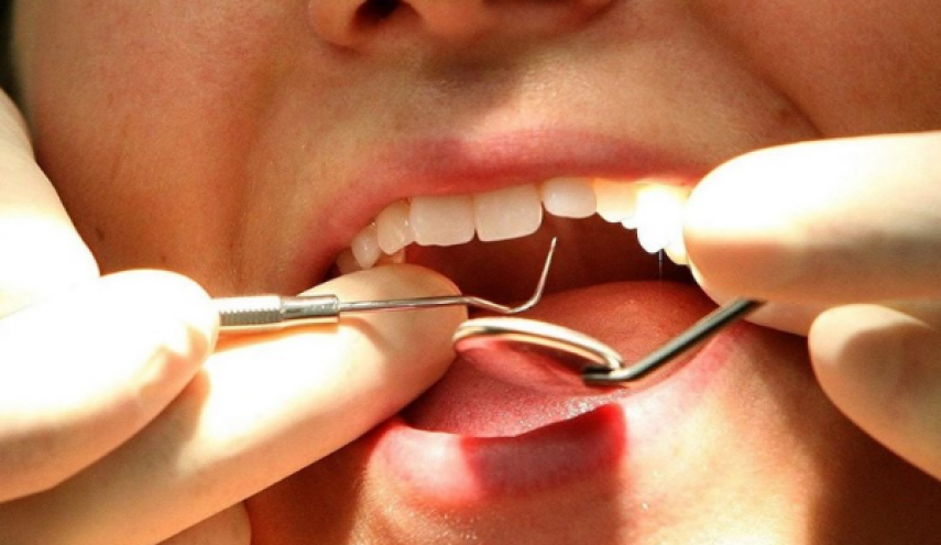 چند روش طبیعی برای خلاصی از جرم دندان
