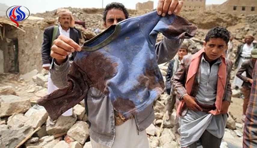 بريطانيا.. مخاوف إزاء الوضع الإنساني في اليمن