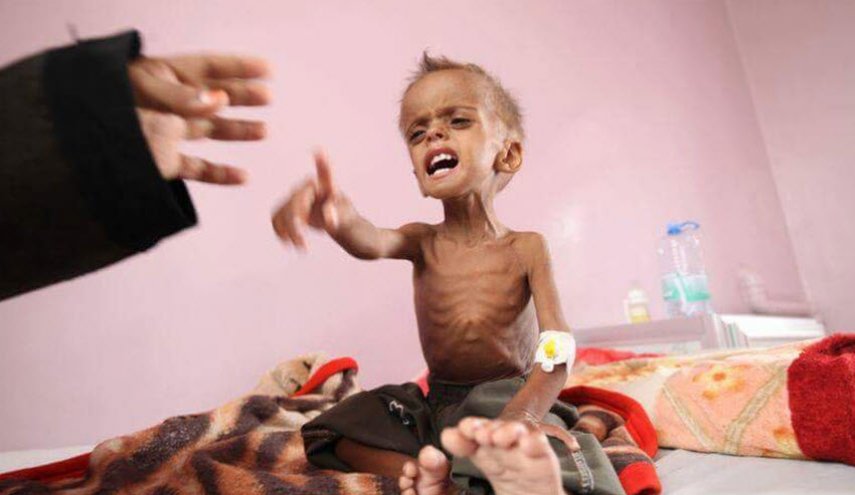 مأساة اليمن ..أبعد من جرائم حرب في ظل التناقضات الامريكية
