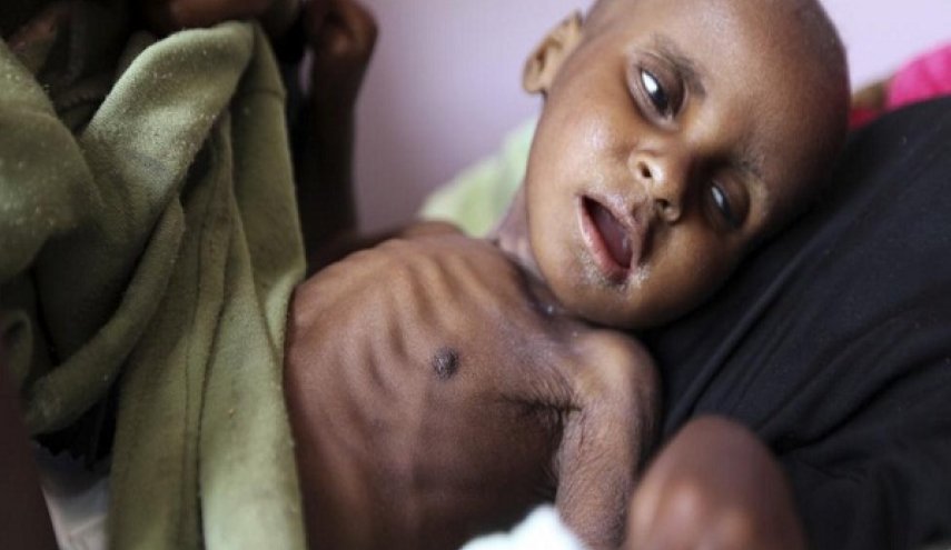 سازمان ملل: یمن بدترین شرایط انسانی روی زمین را دارد