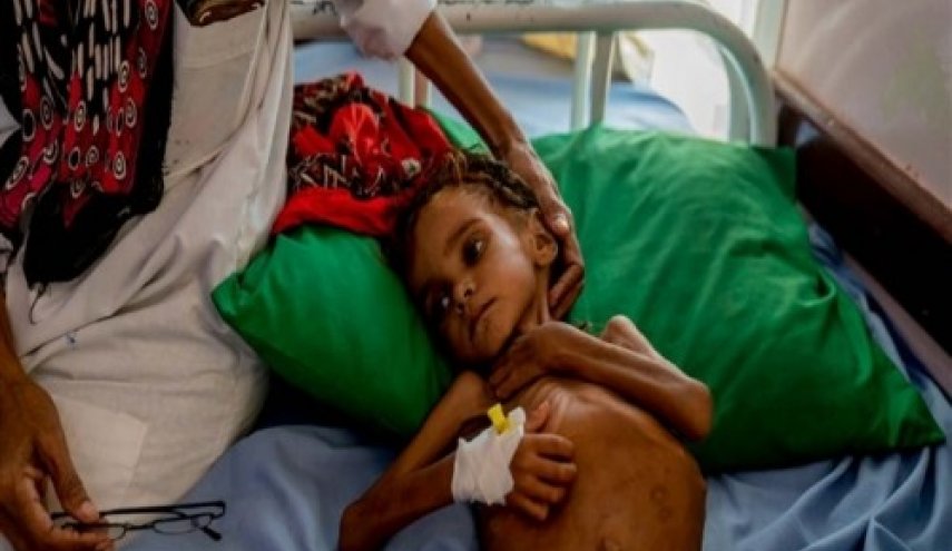 رحيل الطفلة التي فتحت عيون العالم على مأساة اليمن