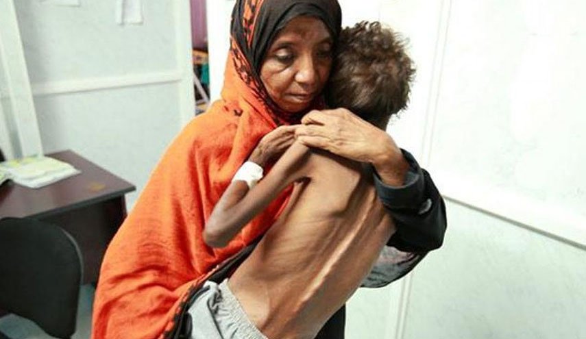 الصحة العالمية: الشعب اليمني بات على حافة المجاعة