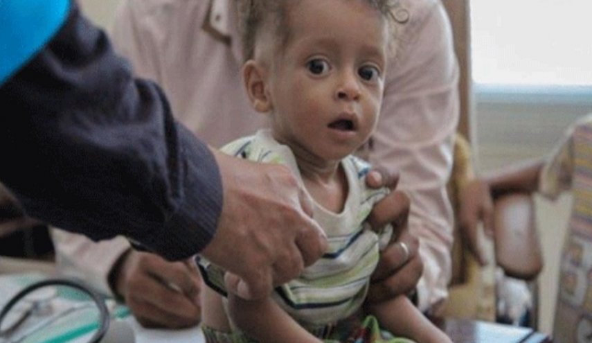 یونیسف: هر 10 دقیقه یک کودک یمنی می میرد
