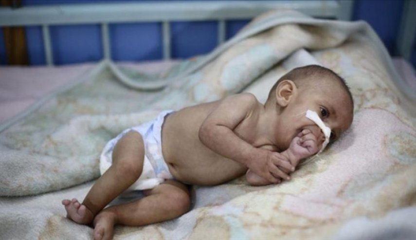 مسؤول أممي: اتفاق السويد لم يطعم طفلا يمنيا واحدا