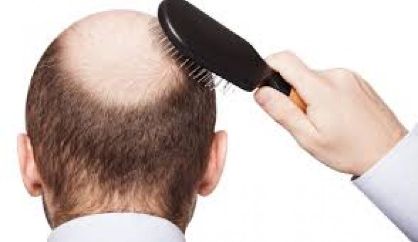 تساقط الشعر يكشف عن مشكلات صحية خطيرة