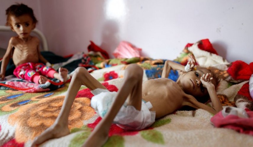  7 آلاف طفل يمني عرضة للموت بسبب نقص التمويل