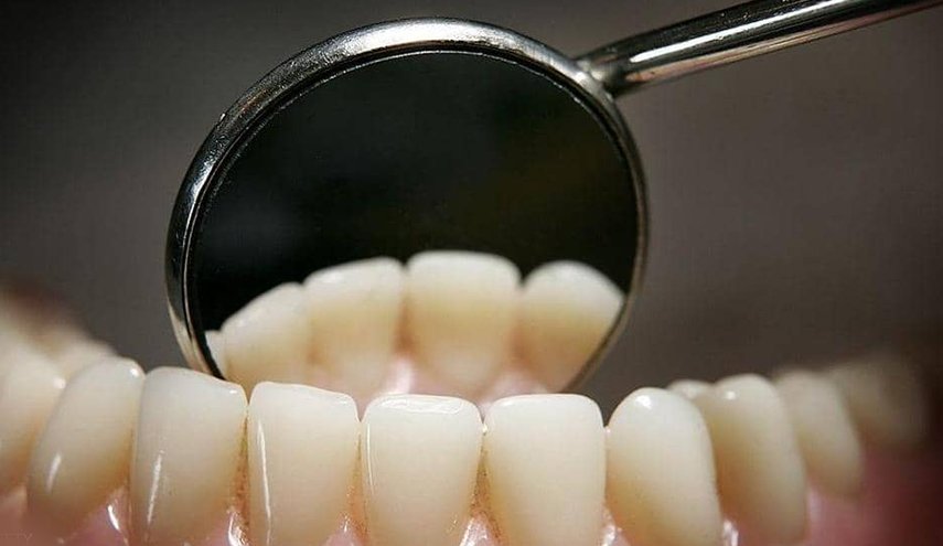 8 نصائح ذهبية لتحمي أسنانك من التسوس 