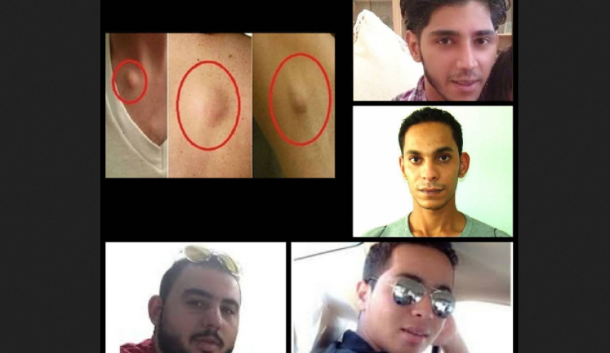 البحرين..معتقلو رأي يصابون بأمراض جديدة قد تكون سرطانية