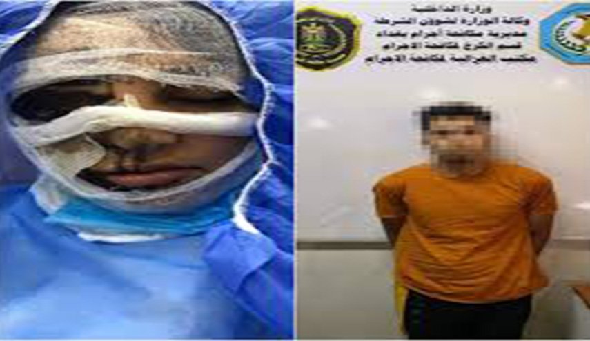 جريمة بشعة تهز بغداد ..مجهولون يحرقون وجه امرأة