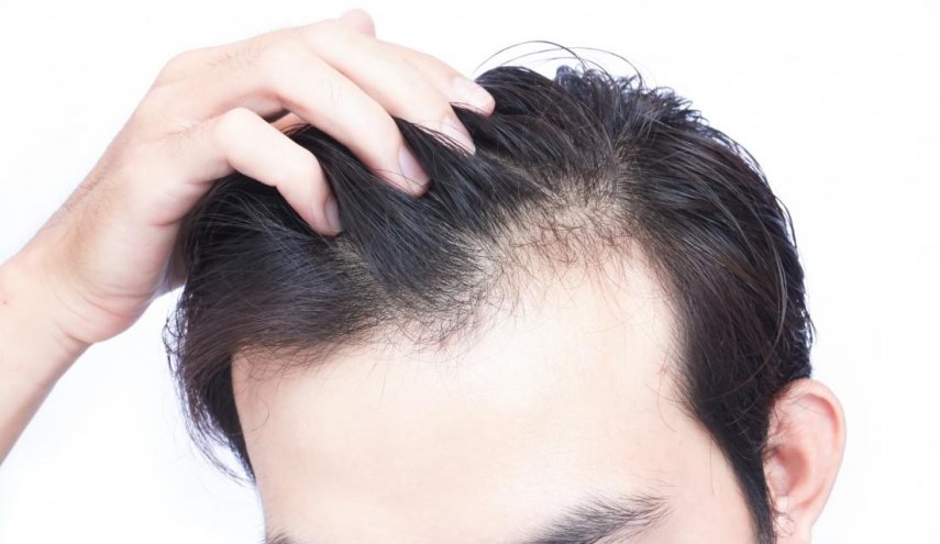 نصائح للتخلص من فراغات الشعر المزعجة بالمواد الطبيعية