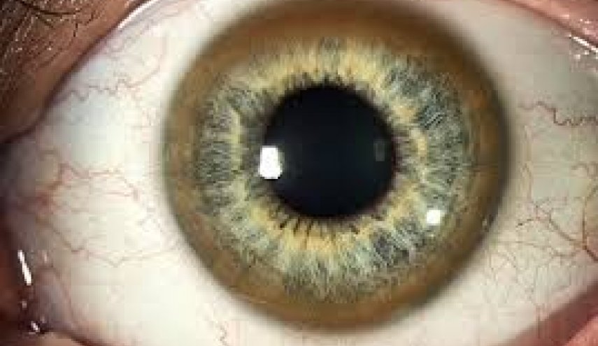 كيف يتنبأ حجم بؤبؤ العين بخطر الوفاة للمصابين؟