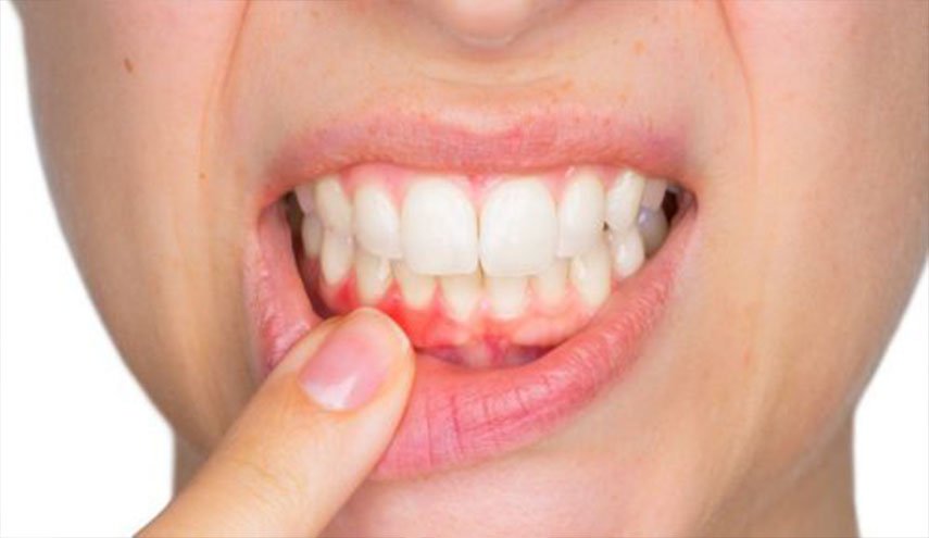 عالج الم اسنانك بشكل طبيعي باستخدام هذه الاطعمة