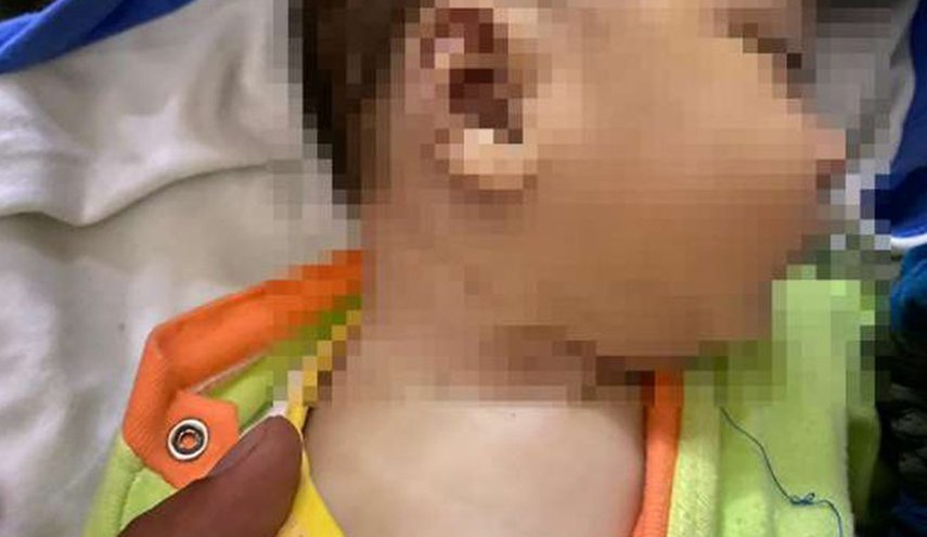 مرگ هولناک نوزاد شیرخواره مصری به دلیل بی مبالاتی والدینش