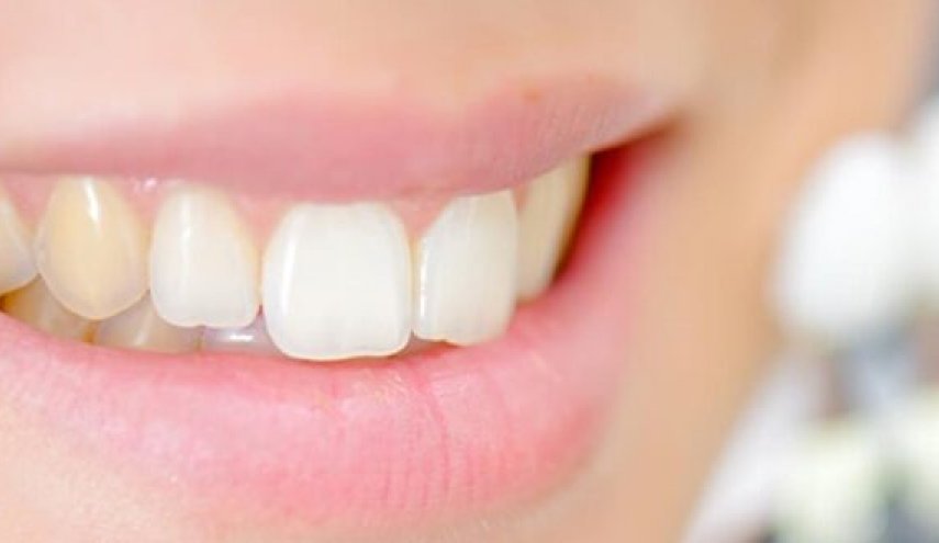 6 طرق للتخلص من اصفرار الاسنان.. دون الحاجة للإنفاق