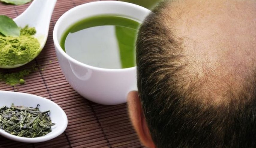 علاج تساقط الشعر.. كيف يمكن للشاي الأخضر أن يمنع الصلع