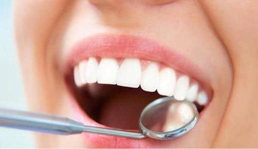 البقع البنية على الأسنان.. هل من طريقة للتخلص منها؟