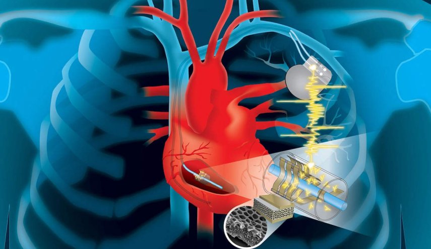 لأول مرة.. تطوير جهاز لتنظيم ضربات القلب من دون بطارية
