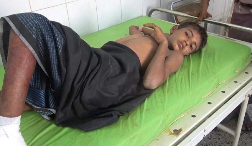 3956 شهيدا وجريحا ضحايا القنابل العنقودية منذ بداية العدوان على اليمن