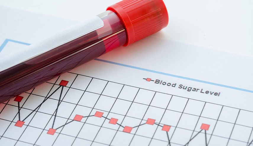 زيادة السكر المضاف تسبب الإصابة بحصوات الكلى