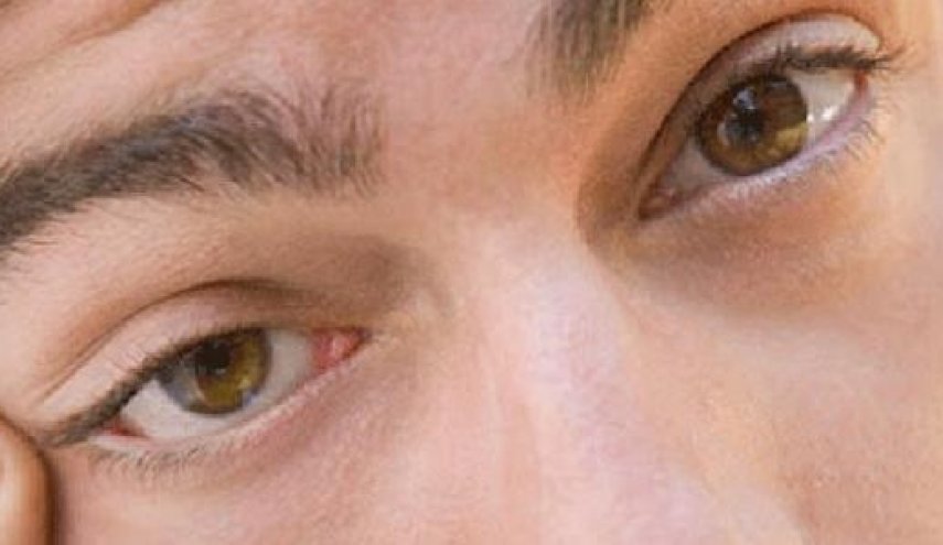 عدد مرات رمش العين قد يكون علامة على مشكلة صحية