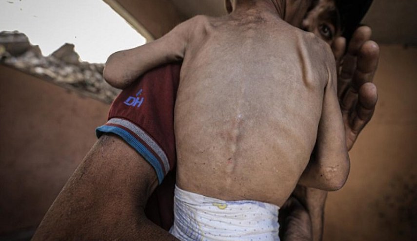 ۶۲۰ فلسطینی به خاطر گرسنگی و نبود دارو  جان باختند/ 69 نفر کودک هستند
